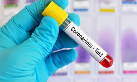 Nuevos 3 casos de Coronavirus se detectaron este miércoles en Rufino