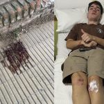 «Lo atacaron por la espalda»: Denuncian feroz agresión en patota a un joven en Rufino