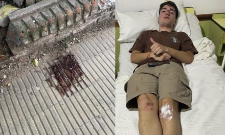 «Lo atacaron por la espalda»: Denuncian feroz agresión en patota a un joven en Rufino
