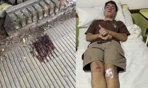 «Lo atacaron por la espalda»: Denuncian feroz agresión en patota a un joven en Rufino