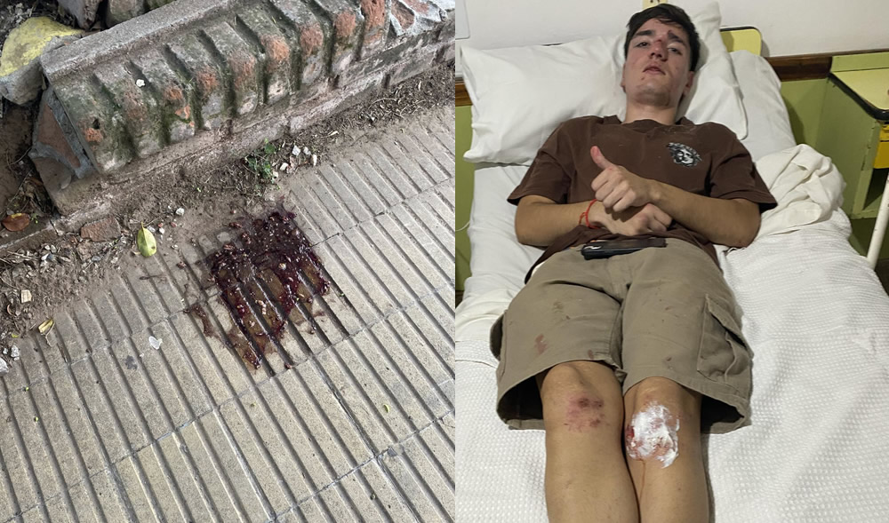 «Lo atacaron por la espalda»: Denuncian feroz agresión en patota a un joven en Rufino